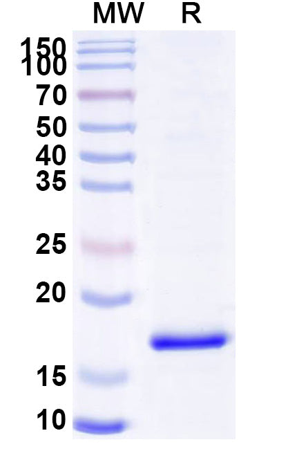 SDS-PAGE for Anti-Human C4b Nanobody (SAA0908)