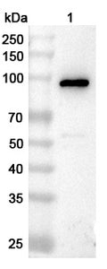 Western blot analysis was performed using anti-C4B polyclonal antibody at 1μg/ml on various samples.
Lane 1: Human plasma lysate