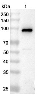 Western blot analysis was performed using anti-C4B polyclonal antibody at 1μg/ml on various samples.
Lane 1: Human plasma lysate