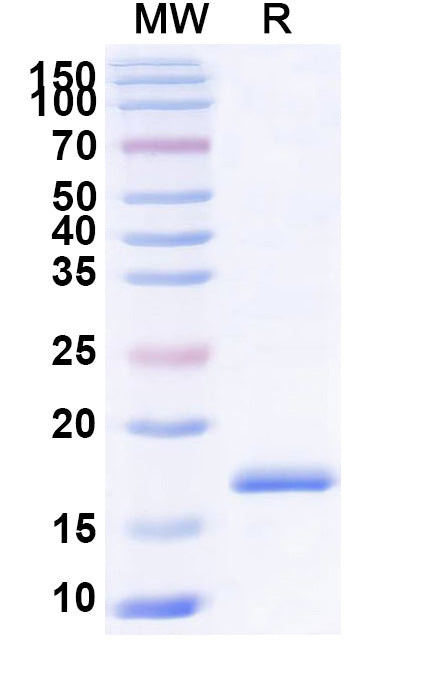 SDS-PAGE for Anti-Human CCL5/RANTES Nanobody (SAA1271)