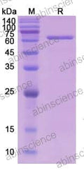 SDS-PAGE for Catalase (CAT)