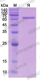 SDS-PAGE for Catalase (CAT)