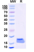 SDS-PAGE for Anti-Human CAT/Catalase Nanobody (SAA1202)
