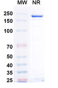 Anti-Human IGF-I R/IGF1R Reference Antibody (Teprotumumab) – Figure 1 of 4