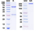 Anti-Human IGF-I R/IGF1R Reference Antibody (Lonigutamab) – Figure 1 of 1