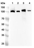 Western blot analysis was performed using anti-ITGA2B  polyclonal antibody at 1ug/mL on various samples.
Lane 1: Mouse spleen lysate
Lane 2: Mouse lung lysate
Lane 3: Rat spleen lysate
Lane 4: Rat lung lysate