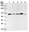Western blot analysis was performed using anti-CETP  polyclonal antibody at 1ug/mL on various samples.
Lane 1: HT-29 cell lysate
Lane 2: MCF-7 cell lysate
Lane 3: A375 cell lysate
Lane 4: Hela cell lysate
Lane 5: Mouse liver lysate