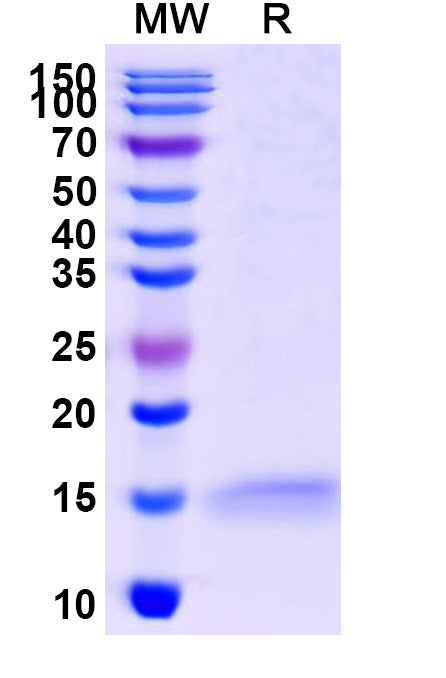 SDS-PAGE for Anti-Human ADRB2 Nanobody (SAA1252)