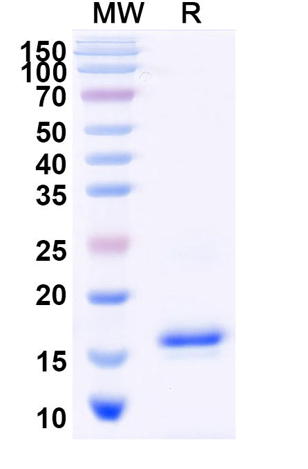 SDS-PAGE for Anti-Human ADRB2 Nanobody (SAA1156)
