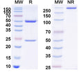 SDS-PAGE for Anti-Human Osteocalcin/BGP/OC Antibody (KTM219).