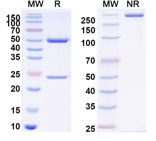 SDS-PAGE for Anti-Human Osteocalcin/BGP/OC Antibody (KTM219).