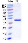 Recombinant Human LPL Protein, N-His