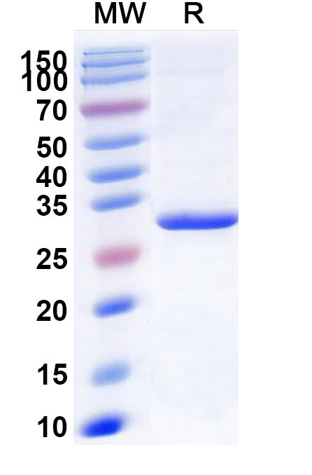 Recombinant Human LPL Protein, N-His