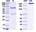 SDS-PAGE for Anti-Human TROP2/TACSTD2/TROP-2 Antibody (FU-MK1)