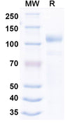 Recombinant Human GAA/Aglucosidase alfa Protein, No tag