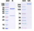 Anti-Human Integrin beta 2/CD18 Reference Antibody (Erlizumab) – Figure 1 of 1