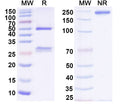 SDS-PAGE for Anti-Human CD18/ITGB2 Antibody (60.3)