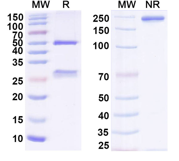 SDS-PAGE for Anti-Human CD18/ITGB2 Antibody (6.7)