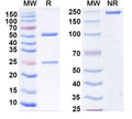 SDS-PAGE for Anti-Human CD18/ITGB2 Antibody (1B4)