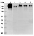 Western blot analysis was performed using anti-LAMC1 polyclonal antibody at 1ug/mL on various samples.
Lane 1: HepG2 cell lysate
Lane 2: A431 cell lysate
Lane 3: DU145 cell lysate
Lane 4: PC-12 cell lysate
Lane 5: MCF-7 cell lysate
