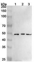 Western blot analysis was performed using anti-RARB  polyclonal antibody at 1ug/mL on various samples.
Lane 1: HUVEC cell lysate
Lane 2: A431 cell lysate
Lane 3: A549 cell lysate