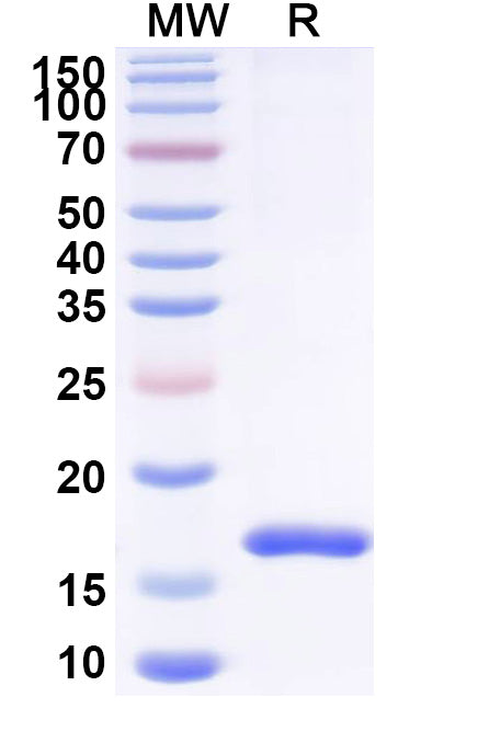 SDS-PAGE for Anti-Human CD16/FcgR3 Nanobody (SAA2149).