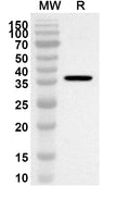 Western blot analysis was performed using anti-KRT10 polyclonal antibody at 1ug/mL on recombinant KRT10 (Catalog No. HY394012).