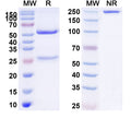 Anti-Human SERPINF2/α2-antiplasmin Reference Antibody (DS9231) – Figure 1 of 1
