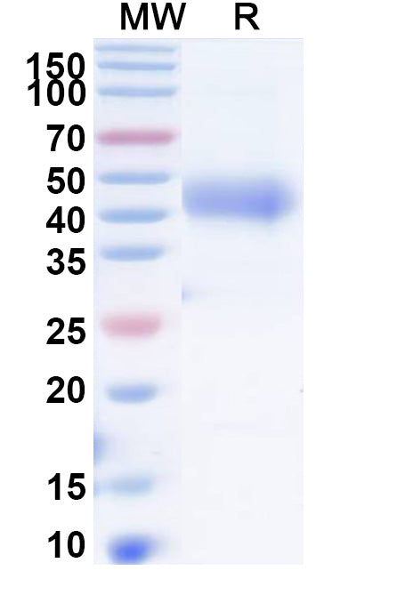 Recombinant Human TFPI Protein, C-His