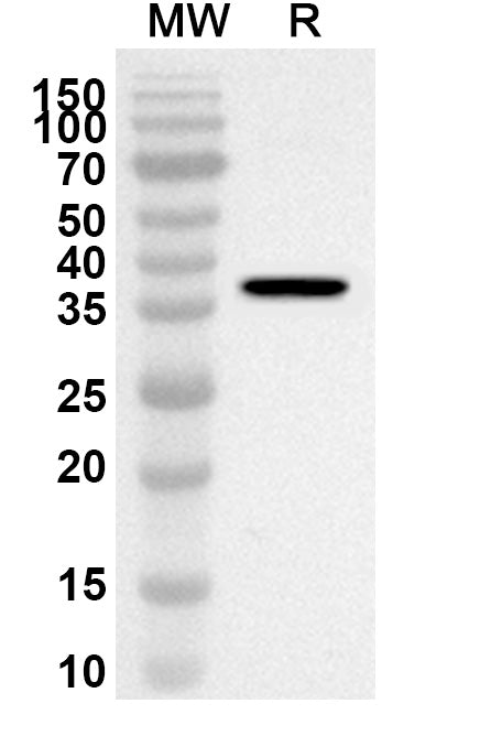 Western blot analysis was performed using anti-CTSH polyclonal antibody at 1ug/mL on recombinant CTSH (Catalog No. HY407012).