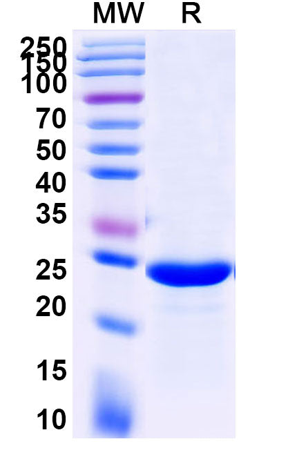 Recombinant Human IL7 Protein, C-His