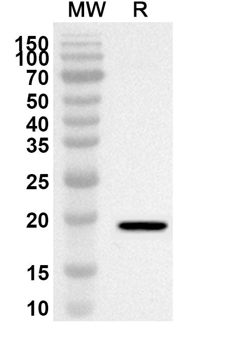 Western blot analysis was performed using anti-IL7 polyclonal antibody at 1ug/mL on recombinant IL7 (Catalog No. HY408012).