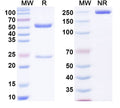 SDS-PAGE for Anti-Human ALB/Albumin/HSA Monoclonal Antibody (1A389)