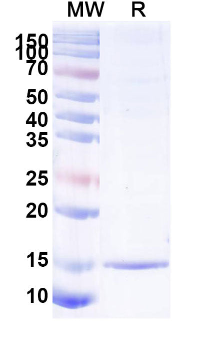 SDS-PAGE for Anti-Human ALB Nanobody (SAA1019)