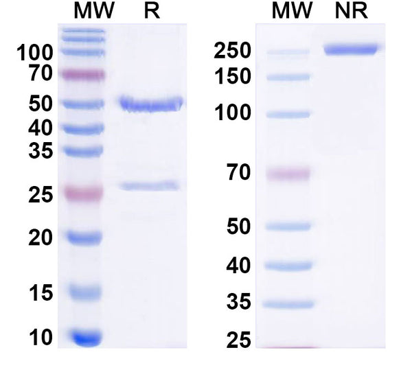 SDS-PAGE for Anti-Human BCHE/CHE1 Antibody (SAA0495)