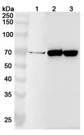 Western blot analysis was performed using anti-BCHE polyclonal antibody at 1ug/mL on various samples.
Lane 1: Hela cell lysate
Lane 2: Jurkat cell lysate
Lane 3: Raji cell lysate
