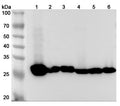Western blot analysis was performed using anti-CA3 polyclonal antibody at 1µg/ml on various samples.
Lane 1: Mouse liver lysate
Lane 2: Mouse lung lysate
Lane 3: Mouse kidney lysate
Lane 4: Rat liver lysate
Lane 5: Rat lung lysate
Lane 6: Rat kidney lysate