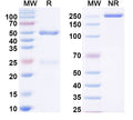 SDS-PAGE for Anti-Human C6/Complement C6 Antibody (SAA0492)