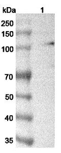 Western blot analysis was performed using anti-C6 polyclonal antibody at 1μg/ml on various samples.
Lane 1: Human plasma lysate