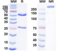 SDS-PAGE for Anti-Human TPO/Thyroid peroxidase Antibody (RI-33)