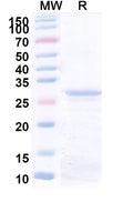 Recombinant Human COL6A1 Protein, N-His