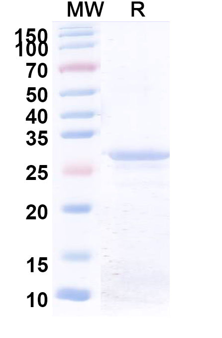 Recombinant Human COL6A1 Protein, N-His