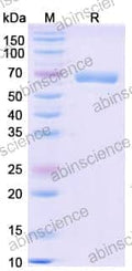 SDS-PAGE for Beta-Hexosaminidase B (HEXB)