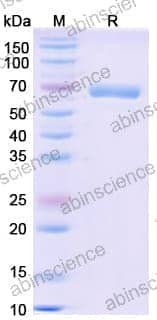 SDS-PAGE for Beta-Hexosaminidase B (HEXB)