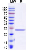 Recombinant Human COL6A3 Protein, N-His