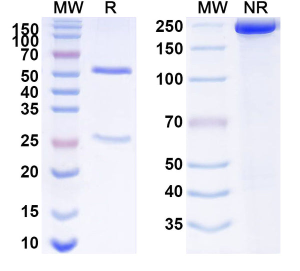 SDS-PAGE for Anti-Human ANXA4 Antibody (SAA1522)