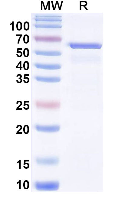 Recombinant Human NR3C1 Protein, N-His
