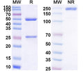 Anti-Human Clusterin Reference Antibody (Sotevtamab) – Figure 1 of 1