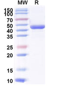 Recombinant Human IL4 Protein, N-mFc