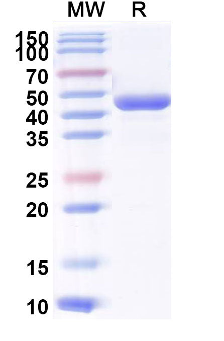 Recombinant Human IL4 Protein, N-mFc